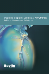 PRM-00887 Mapping Idiopathic Ventricular Arrhythmias Clinical Dossier 
